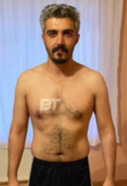 Öncesi